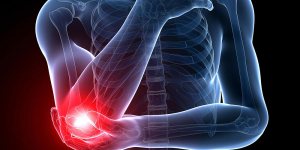 What Is Elbow Pain At Night (Tennis Elbow Pain) in 2020?