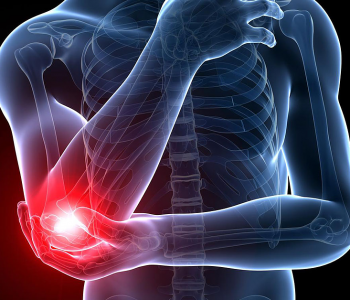 What Is Elbow Pain At Night (Tennis Elbow Pain) in 2020?