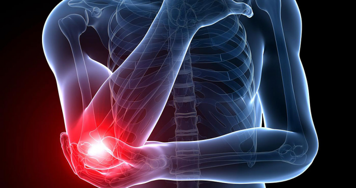 What Is Elbow Pain At Night (Tennis Elbow Pain) in 2020?