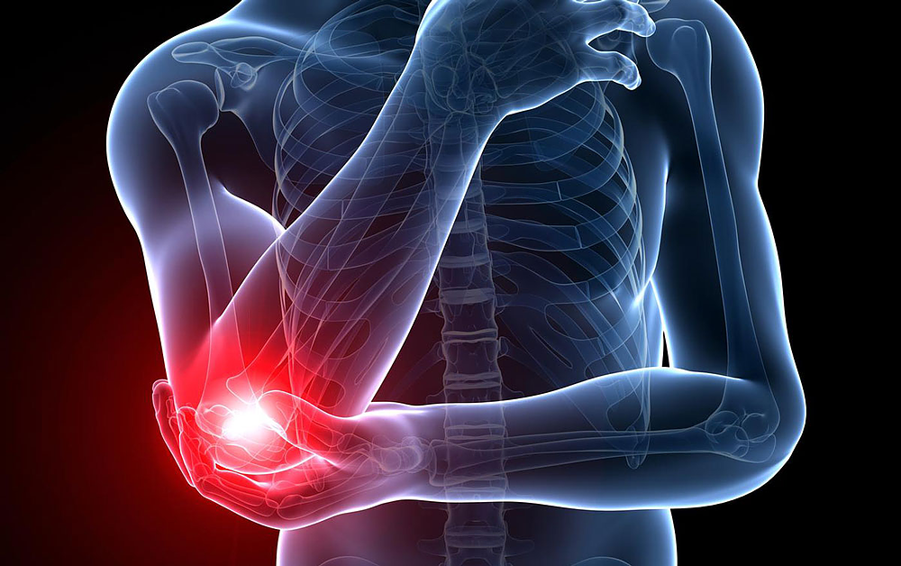 What Is Elbow Pain At Night (Tennis Elbow Pain) in 2020?