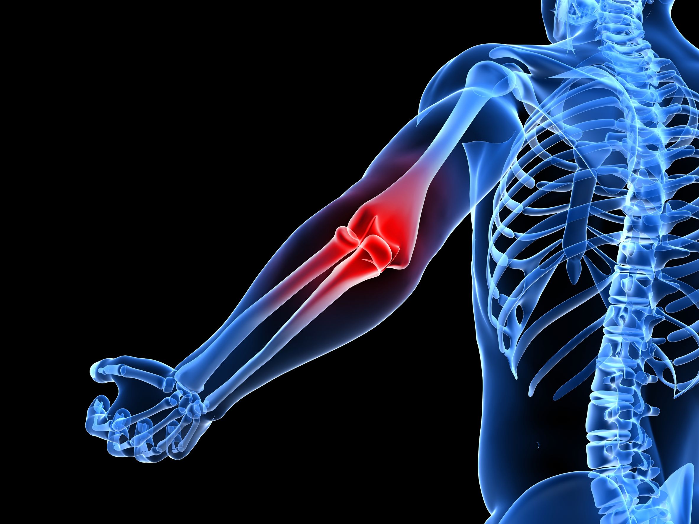 What Is Elbow Pain At Night (Tennis Elbow Pain) in 2020?